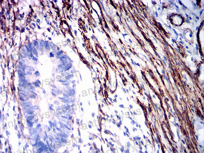Валидация AntibodySystem RHF52707