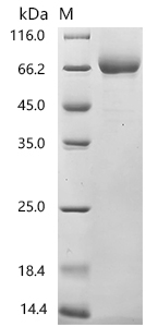 SDS-PAGE