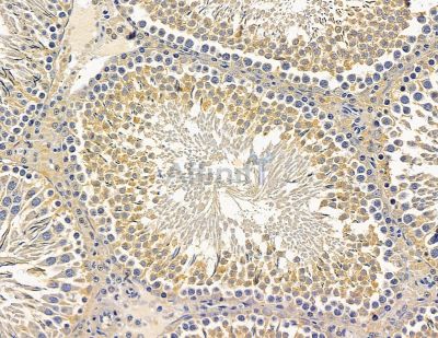 Валидация Affinity DF14918 - 11087