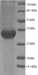 SDS-PAGE