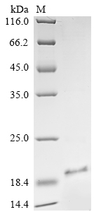 SDS-PAGE