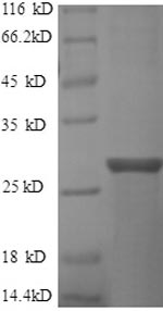 SDS-PAGE
