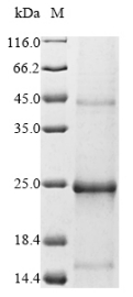 SDS-PAGE