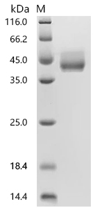 SDS-PAGE