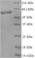 SDS-PAGE
