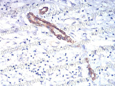 Валидация AntibodySystem RHB92601 (461)