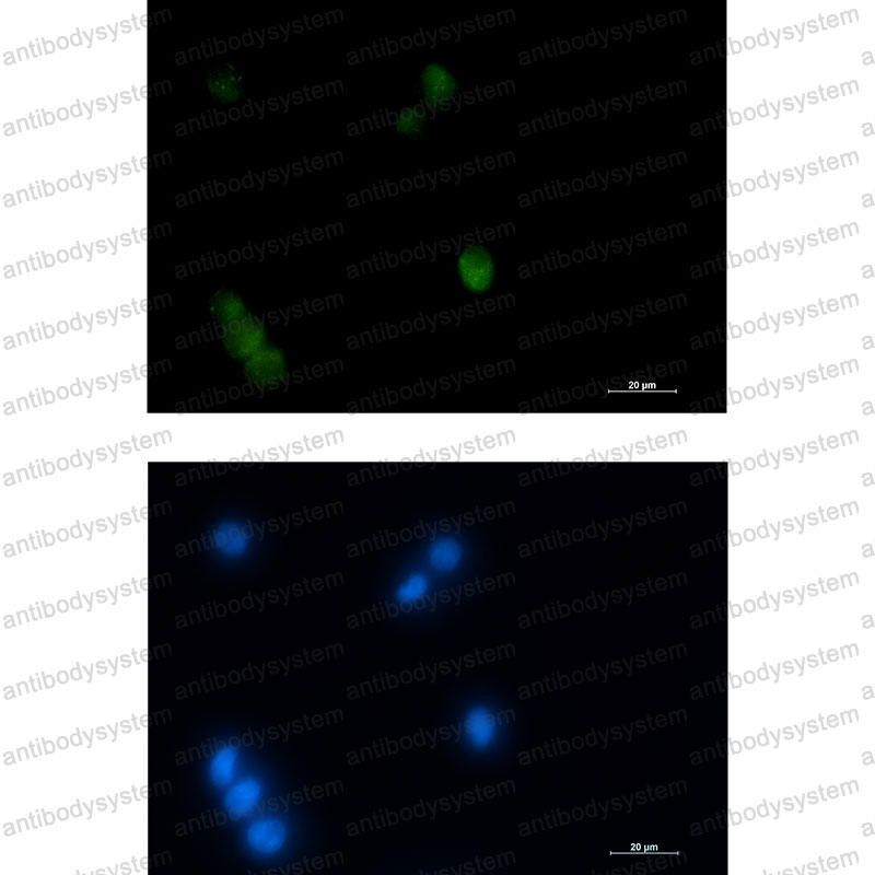 Валидация IF - AntibodySystem RHE44604