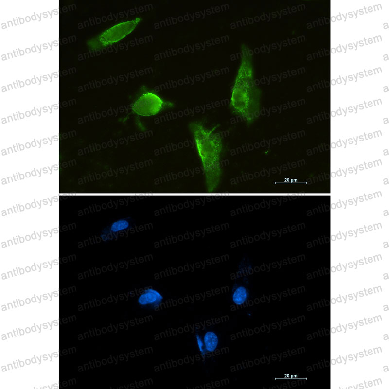 Валидация IF - AntibodySystem RHN81801