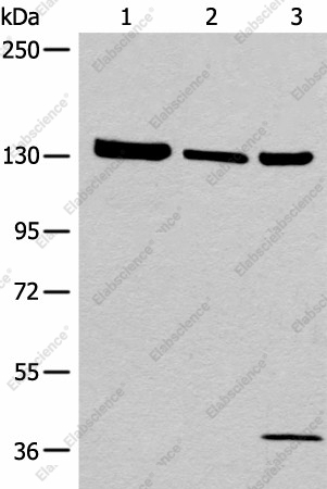 Вестерн-блоттинг, EPHA6, клетки 293T, ткань яичка человека, клетки A549
