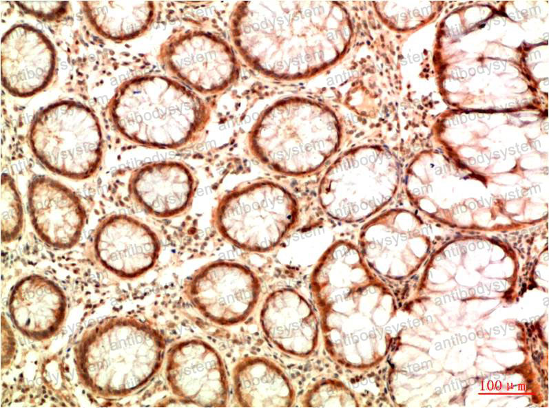 Валидация AntibodySystem RHC10009 (620)