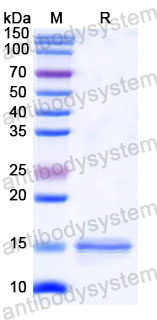 Валидация SDS-PAGE - AntibodySystem RHD15005