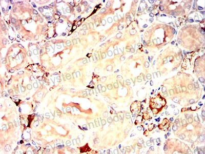 Валидация AntibodySystem RHD71002 (1746)