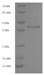 SDS-PAGE