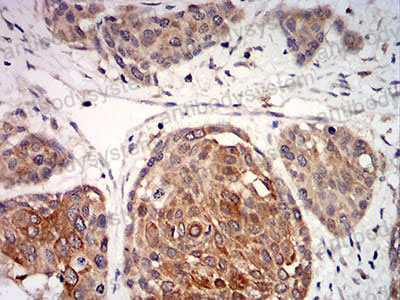 Валидация AntibodySystem RVV44701 (4207)