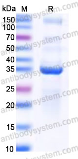 YHG30704, SDS-PAGE