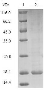 SDS-PAGE