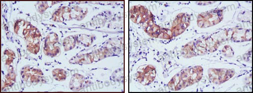 Валидация AntibodySystem RHC65201