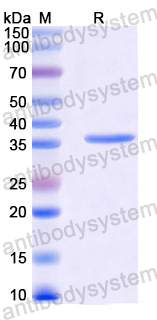 YMK17401, SDS-PAGE
