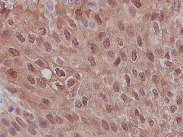 Валидация AntibodySystem RHD68501 (1714)