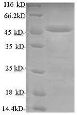 SDS-PAGE