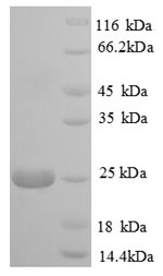SDS-PAGE