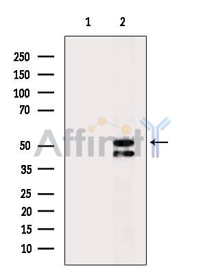 Валидация Affinity AF3961 - 2088