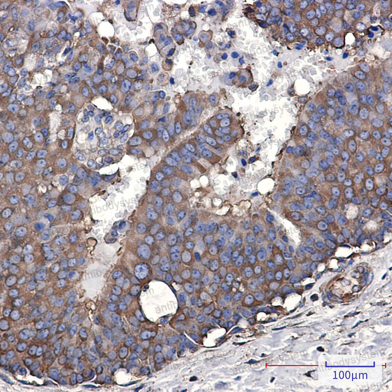Валидация AntibodySystem RHC99104