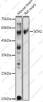 Вестерн-блоттинг, SOX1, различные клеточные линии