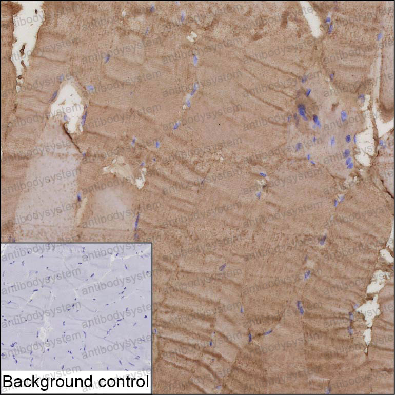 Валидация AntibodySystem RHK81401