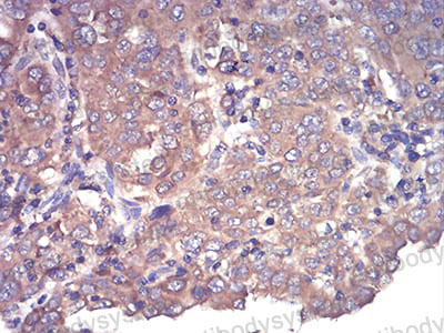 Валидация AntibodySystem RHN95201