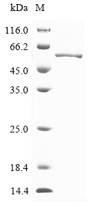 SDS-PAGE