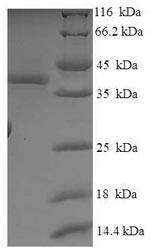 SDS-PAGE