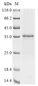 SDS-PAGE