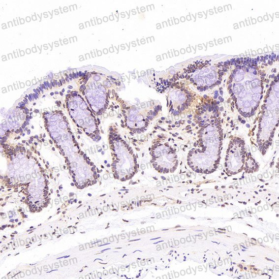 Валидация AntibodySystem RHJ51602 (3445)