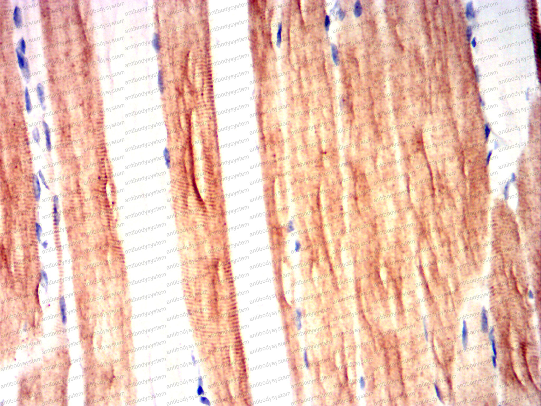 Валидация AntibodySystem RHJ82304 (3560)