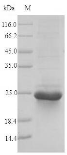 SDS-PAGE