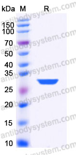 YHA48902, SDS-PAGE