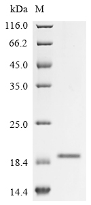 SDS-PAGE
