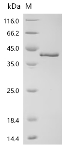SDS-PAGE