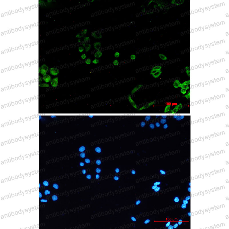 Валидация IF - AntibodySystem RHN87901