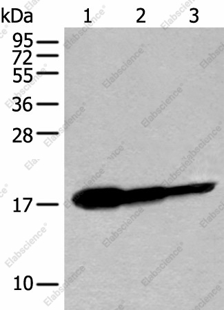 Вестерн-блоттинг, UBE2V1, ткань мозга плода человека и клеточные линии HT-29 и Jurkat