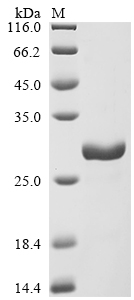 SDS-PAGE
