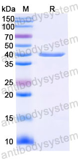 Валидация SDS-PAGE - AntibodySystem RHJ69204
