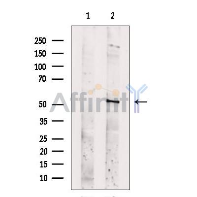 Валидация Affinity DF13644 - 9193