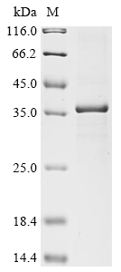 SDS-PAGE