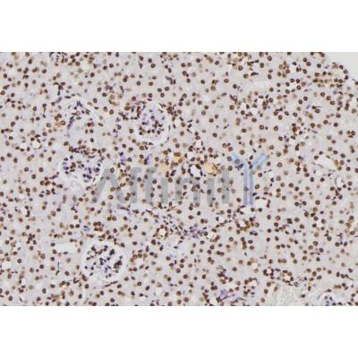 Валидация Affinity DF6568 - 18008