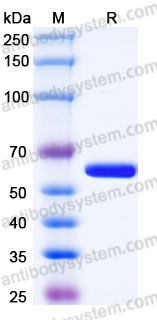 AHK85302, SDS-PAGE