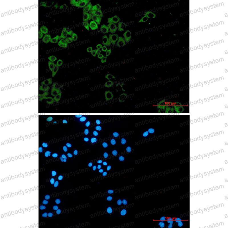 Валидация IF - AntibodySystem RHE62403