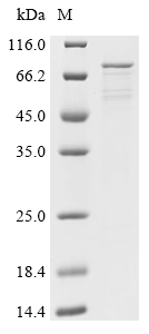 SDS-PAGE