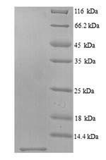 SDS-PAGE